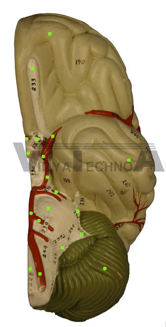 Circle of Willis - Torso Brain